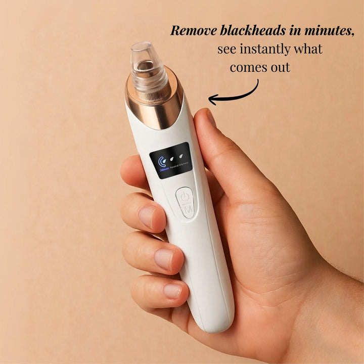 Blackhead Remover Vacuum Pore Cleanser with 3 Suction Levels 1