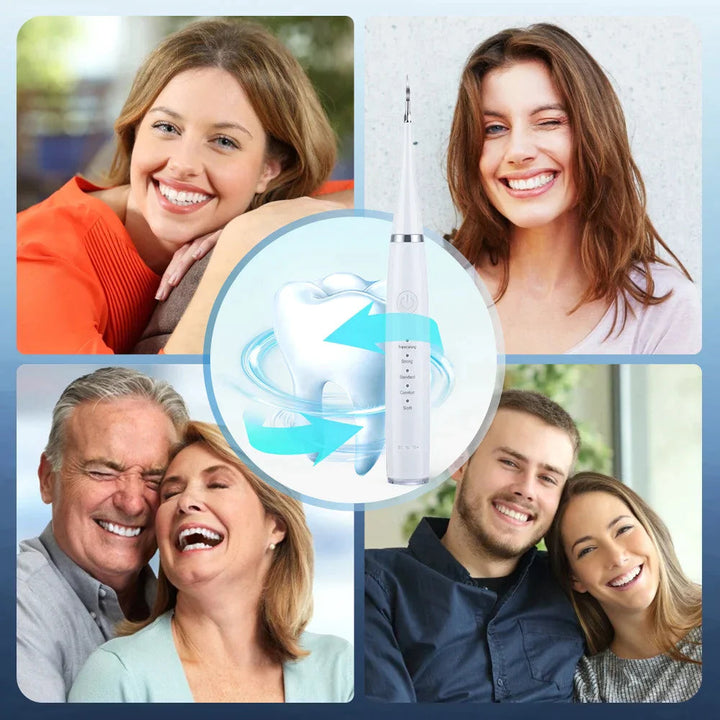 Ultrasonic Tooth Cleaner with 5 Power Levels and 3 Interchangeable Brush Heads 3