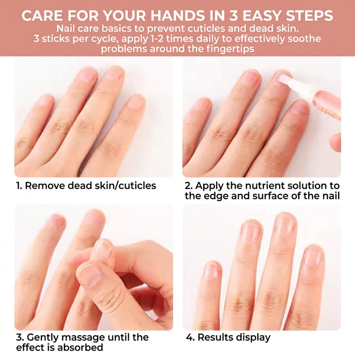 Nutrient-Rich Nail Growth Oil with Vitamin E, C and B7 5