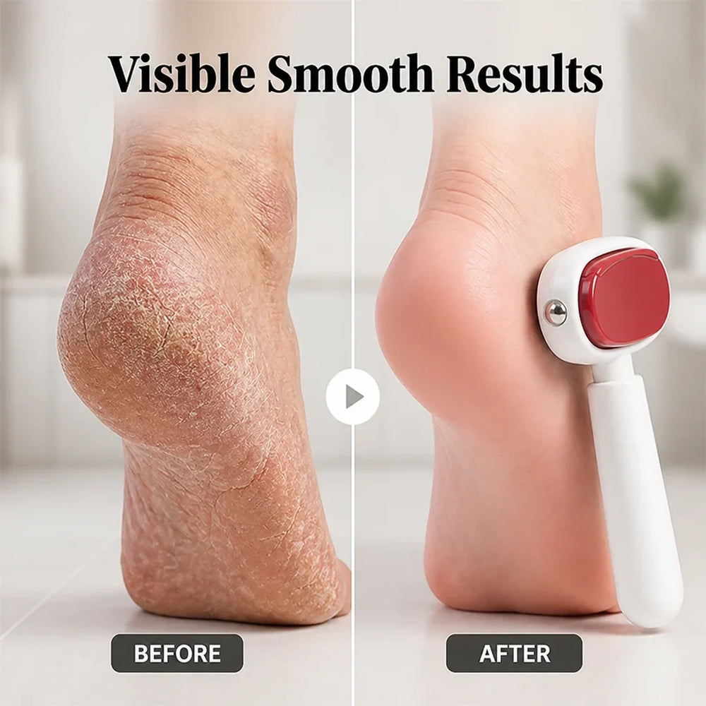 Double-Sided Stainless Steel Foot File and Callus Remover, Portable 2