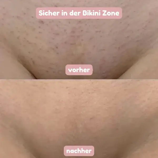 2-in-1 Women's Shaver for Smooth, Gently Cared-For Skin 8
