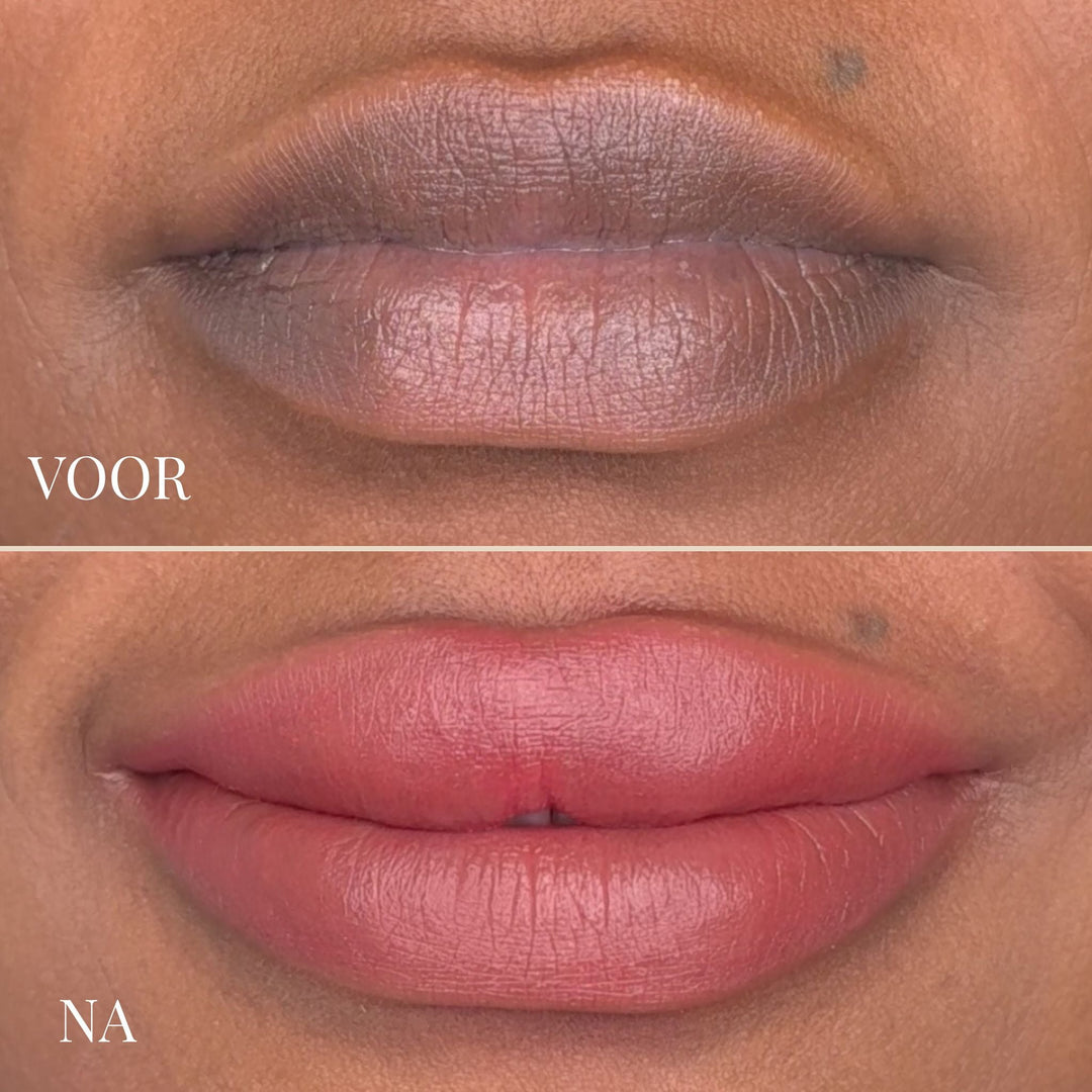 Lemon Lip Balm - Brightening Lip Treatment for Dark Lips 6