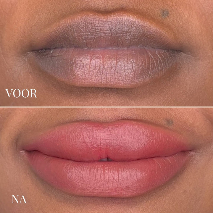 Lemon Lip Balm - Brightening Lip Treatment for Dark Lips 6