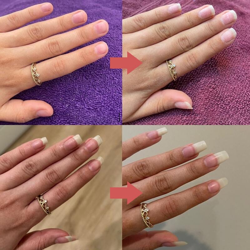 Nutrient-Rich Nail Growth Oil with Vitamin E, C and B7 9