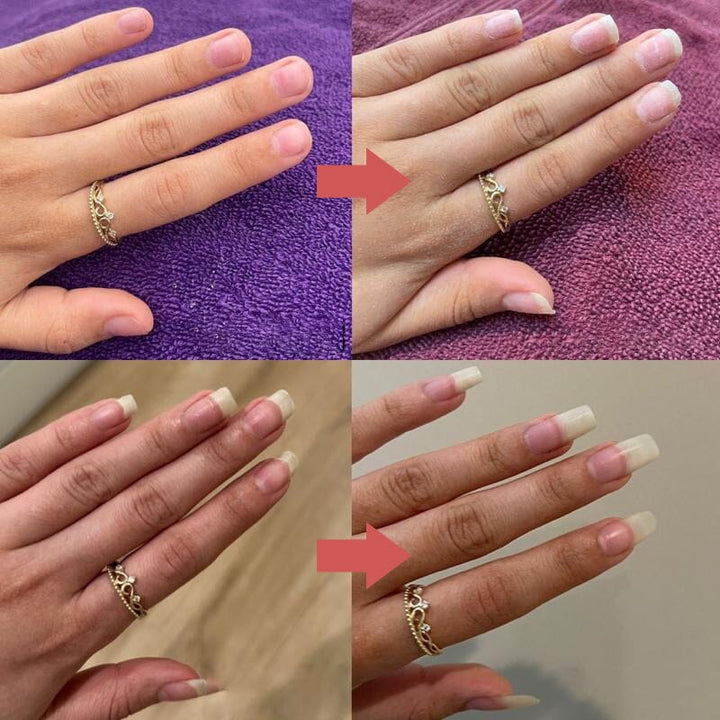Nutrient-Rich Nail Growth Oil with Vitamin E, C and B7 9