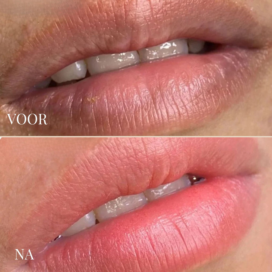 Lemon Lip Balm - Brightening Lip Treatment for Dark Lips 7