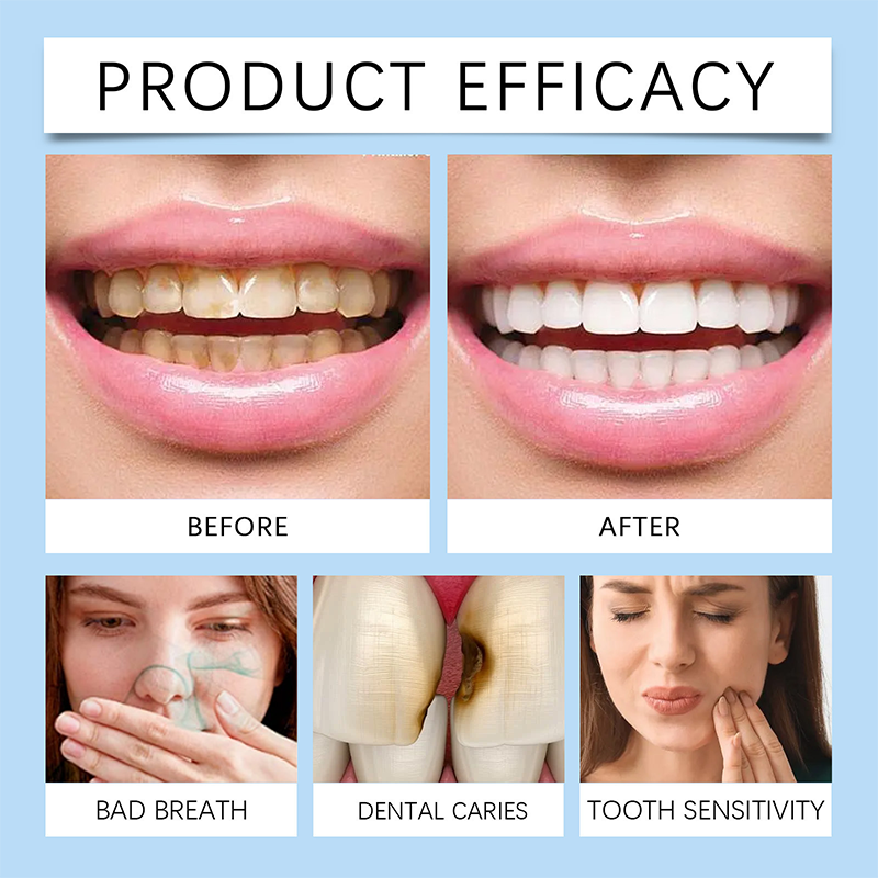 Enamel Repair Spray — Instant Strength & Sensitivity Relief for Bold Smiles 4