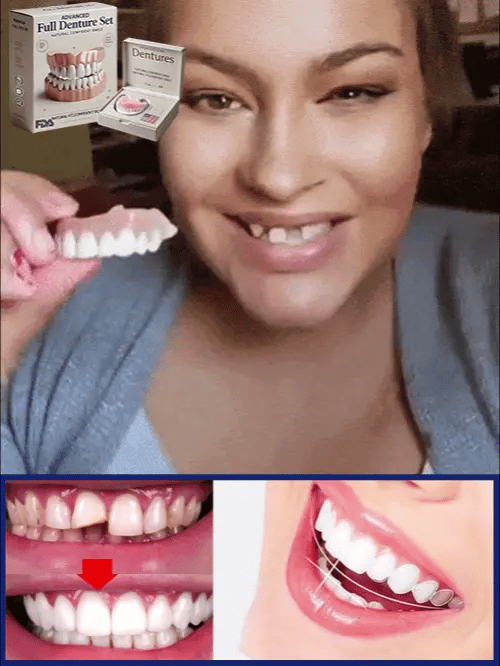 Custom Moldable Cosmetic Denture Set – Reusable Upper & Lower Jaw Solution