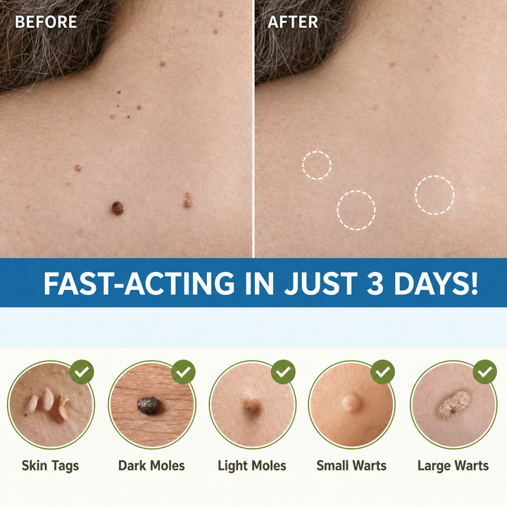 Skin Tag Remover Patches | Painless Gentle Skin Tag Removal Patch 4
