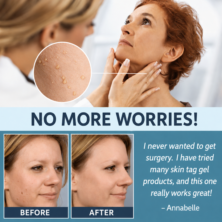 Skin Tag Remover Patches | Painless Gentle Skin Tag Removal Patch 5
