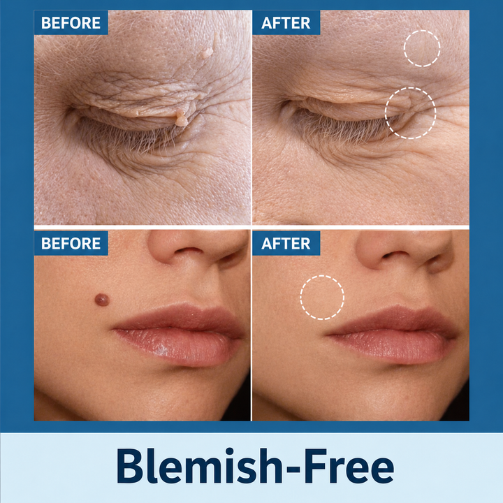 Skin Tag Remover Patches | Painless Gentle Skin Tag Removal Patch 7