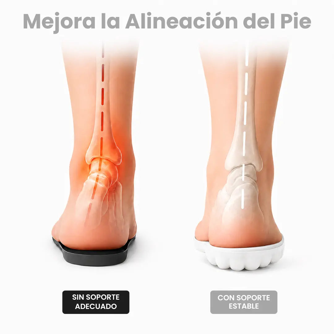 Orthopedic Insoles for Heel Spurs and Plantar Fasciitis 2