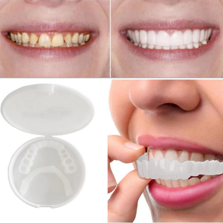 Snap-On Veneers for a Natural-Looking White Smile, Reusable and Glue-Free 4