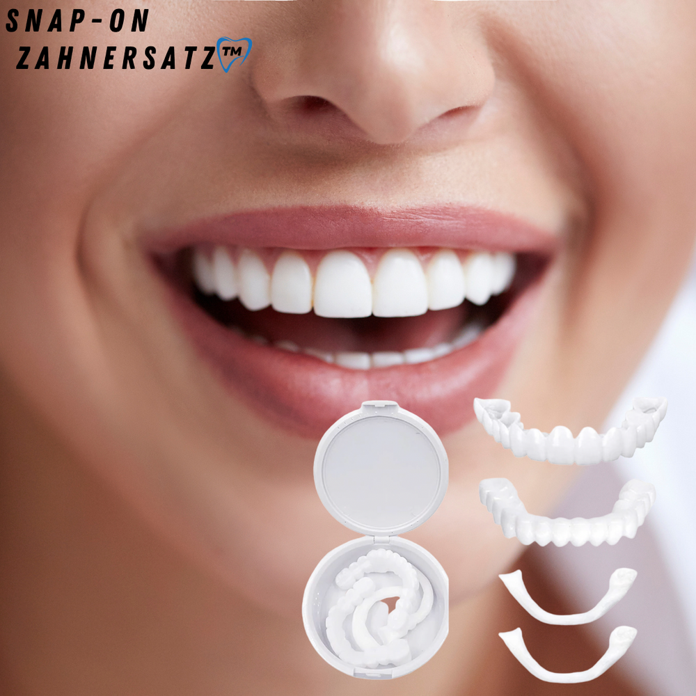 Snap-On Veneers for a Natural-Looking White Smile, Reusable and Glue-Free 2