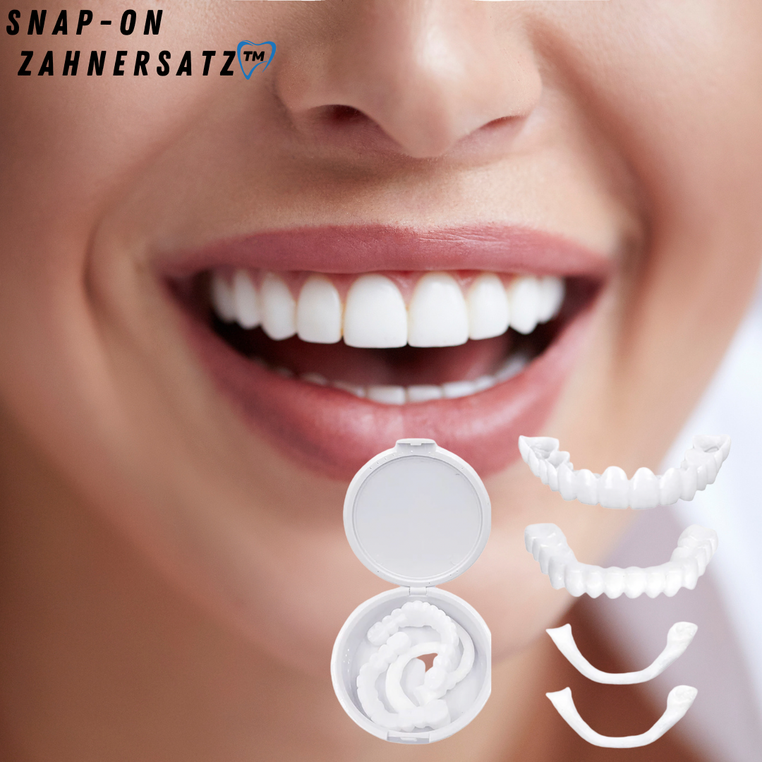 Snap-On Veneers for a Natural-Looking White Smile, Reusable and Glue-Free 2