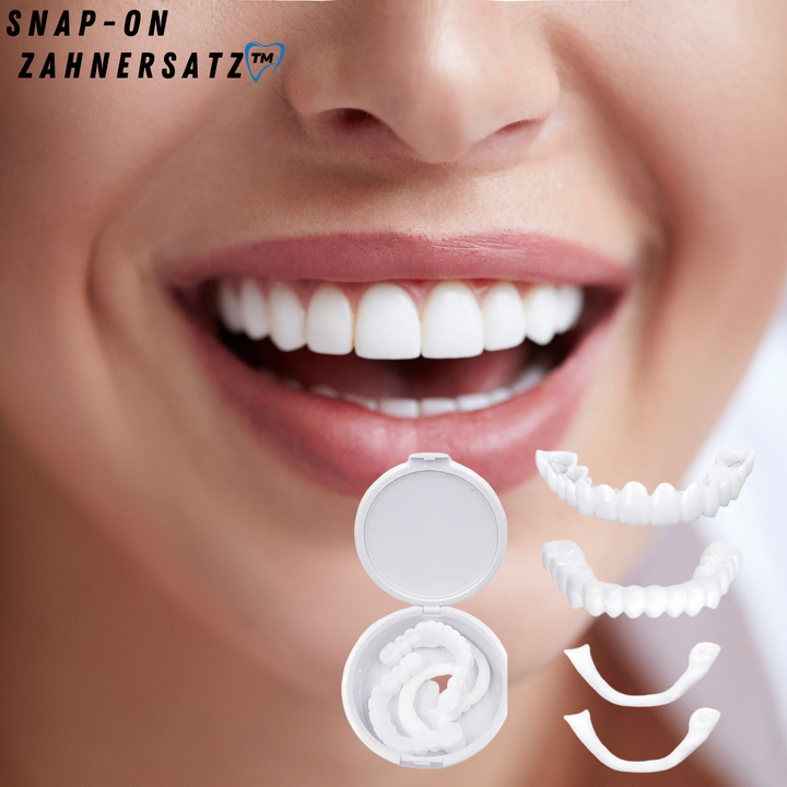 Snap-On Veneers for a Natural-Looking White Smile, Reusable and Glue-Free 2