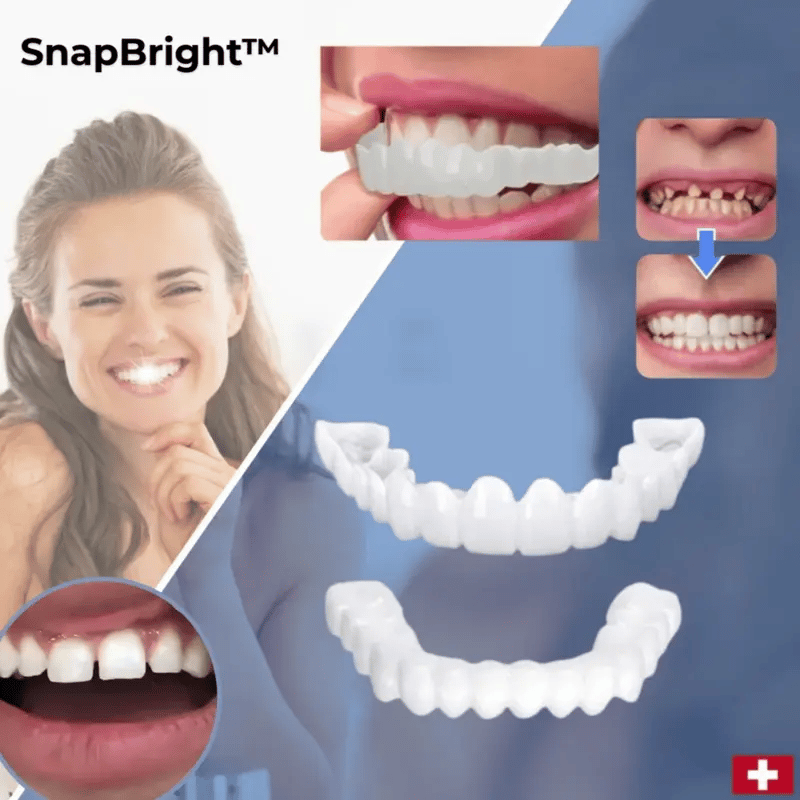 Snap-On Veneers for a Natural-Looking White Smile, Reusable and Glue-Free 1