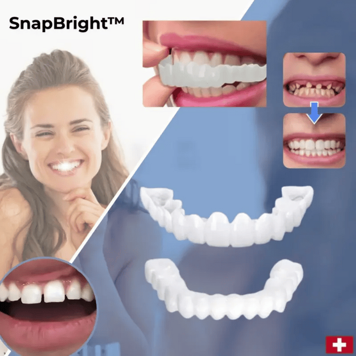 Snap-On Veneers for a Natural-Looking White Smile, Reusable and Glue-Free 1