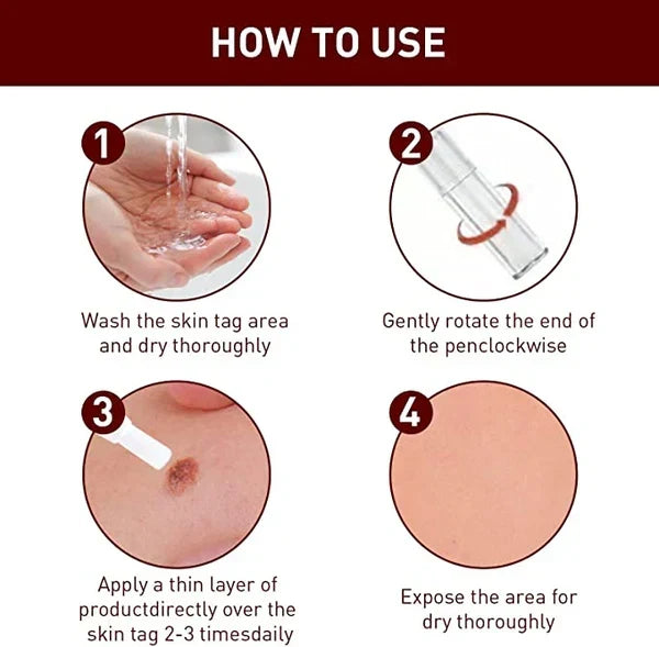 Effective Skin Tag & Mole Remover for Clear Skin 3