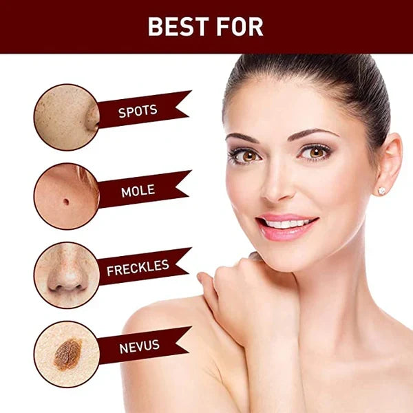 Effective Skin Tag & Mole Remover for Clear Skin 7