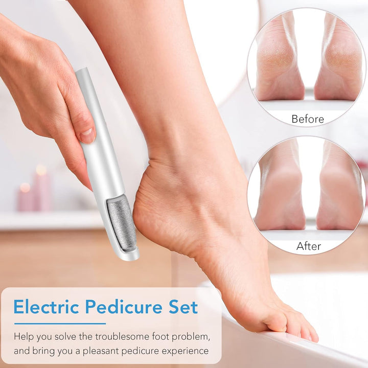 Cordless Electric Foot Callus Remover with 3 Speeds, Dual Rollers and USB-C 2