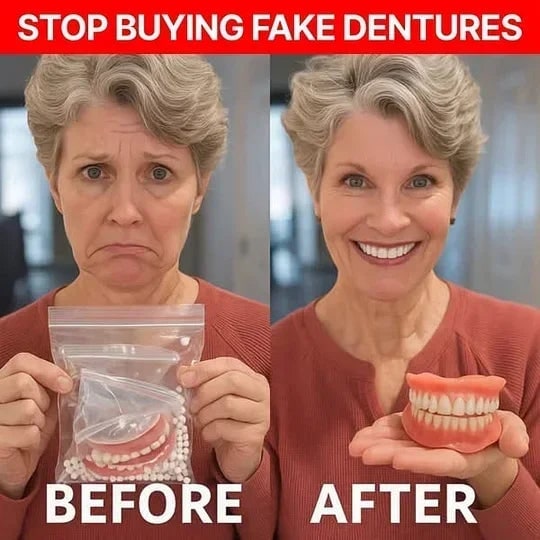 Removable Full Arch Denture Set with Flexible Cushion Grip for Everyday Wear 10