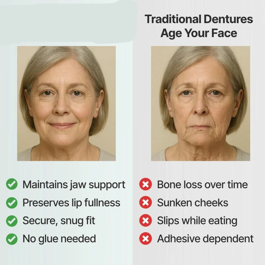 Removable Full Arch Denture Set with Flexible Cushion Grip for Everyday Wear 7