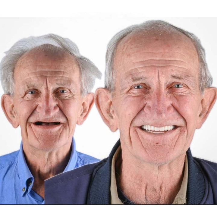 Removable Full Arch Denture Set with Flexible Cushion Grip for Everyday Wear 6